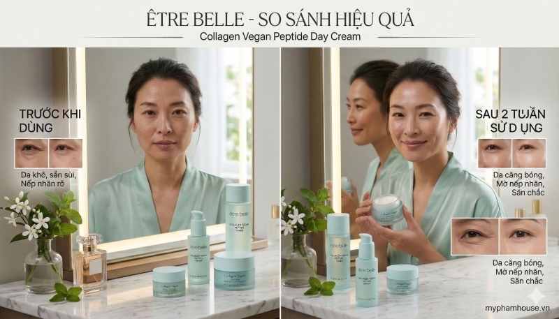 https://myphamhouse.vn/san-pham/etre-belle-collagen-vegan-peptide-day-cream-cap-am-sau-nang-co-san-chac-da-tuc-thi.html