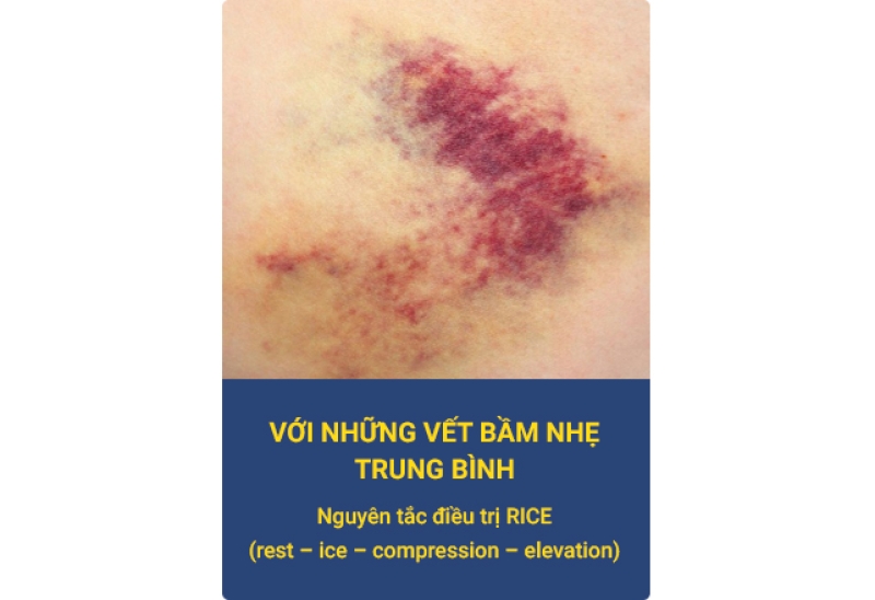 nho_
cc1-1755515622.jpg