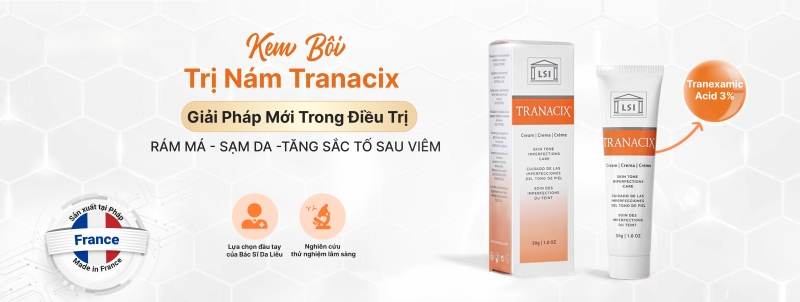 Kem hỗ trợ trị nám và tàn nhang _ Tranacix Cream Skin Tone Imperfections Care 